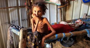الفاو تحذّر من القيود المفروضة على العمل الإنساني بمناطق الحوثيين وانزلاق اليمن إلى “المجاعة”