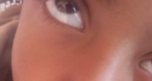 مناشدات عاجلة في الضالع جراء تفشي وباء “فطريات اللسان” بين أطفال منطقة تورصة