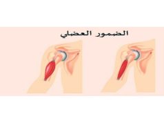 علماء روس يعملون على ابتكار أول دواء في العالم لعلاج ضمور العضلات