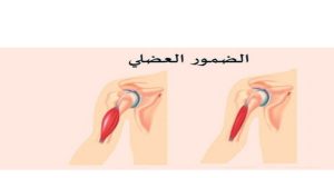 علماء روس يعملون على ابتكار أول دواء في العالم لعلاج ضمور العضلات