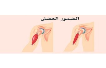 علماء روس يعملون على ابتكار أول دواء في العالم لعلاج ضمور العضلات