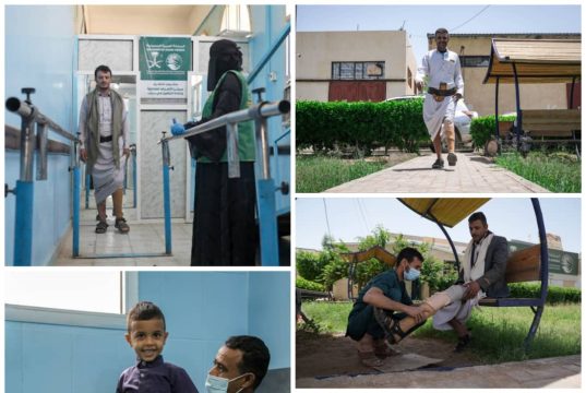 مركز الأطراف الصناعية بمأرب يعلن عن تقديمه خدمات مميزة خلال شهر ابريل المنصرم