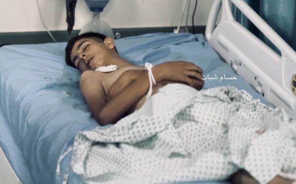 وفاة شاب فلسطيني في غزة جراء سوء التغذية